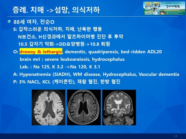 b32e71479ac48067a68aa83030a36dc1_1792026